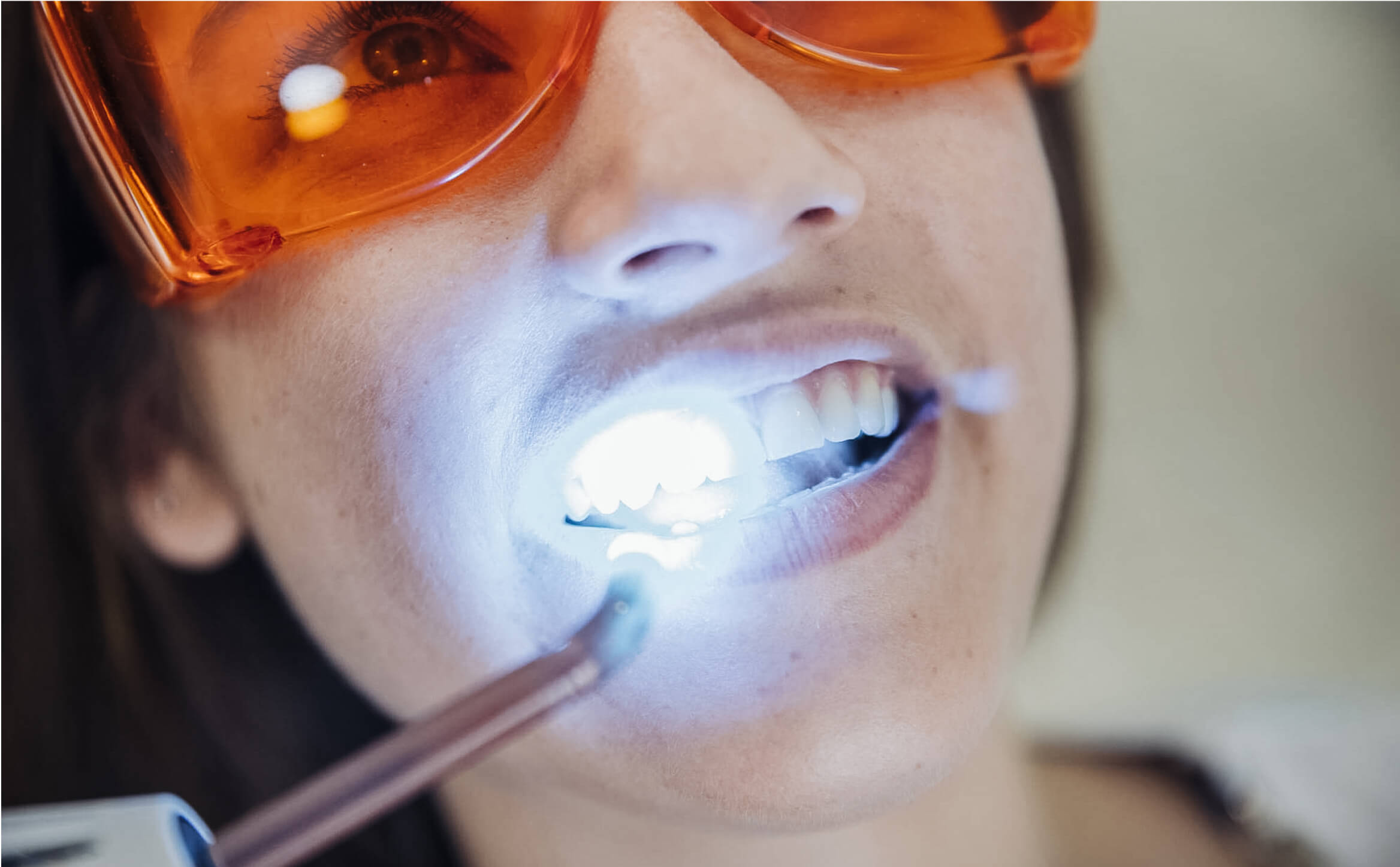 clinica pieza blanqueamiento dental